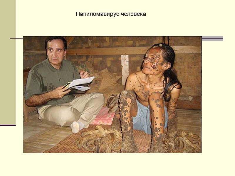 Папиломавирус человека